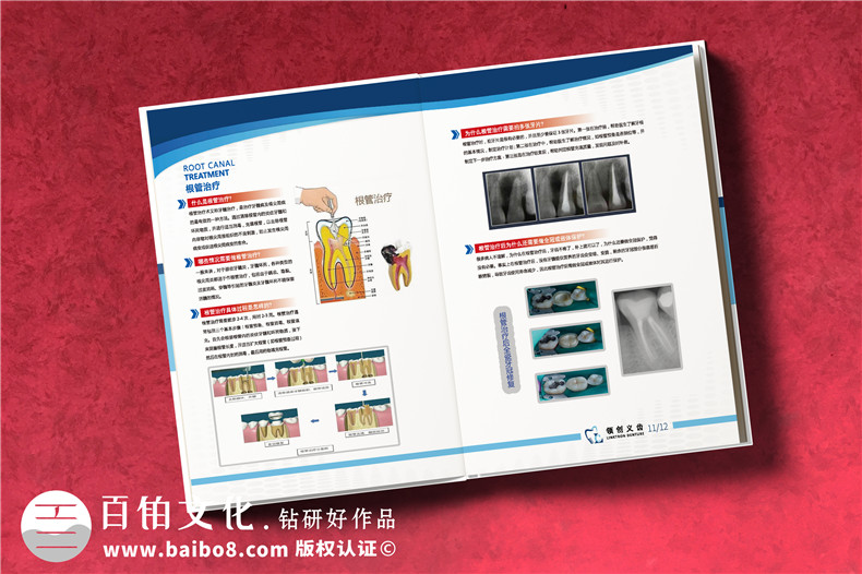 成都義齒產(chǎn)品宣傳畫冊(cè)設(shè)計(jì)-牙科技術(shù)開發(fā)產(chǎn)品冊(cè)